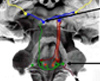 biomedical acoustics