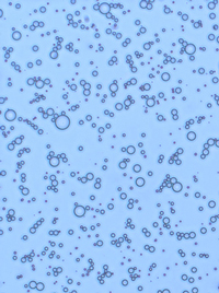 microbubble contrast agents