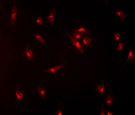 cervical carcinoma cells