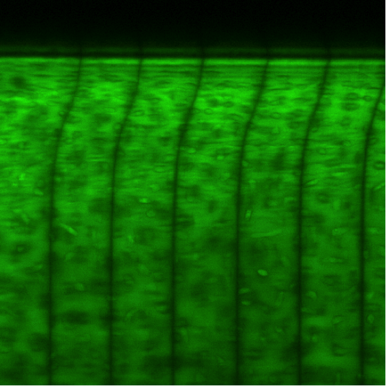 confocal micrograph