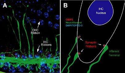 inner hair cell