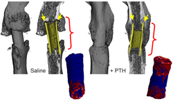 massive bone 2