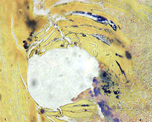 gram stained tibia