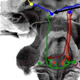 auditory processing of complex sounds