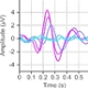 diagnostic tests auditory