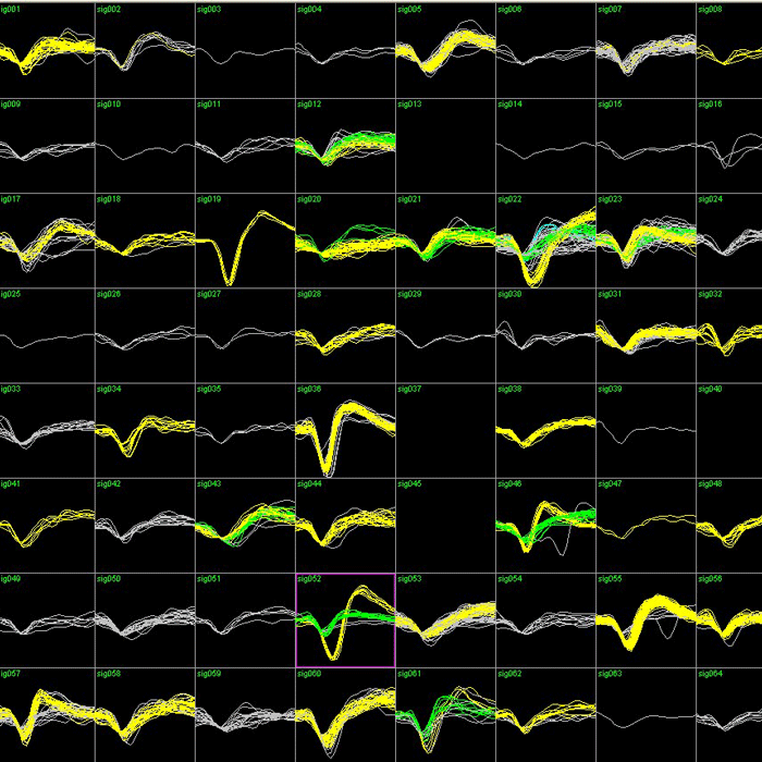 neuron action potentials