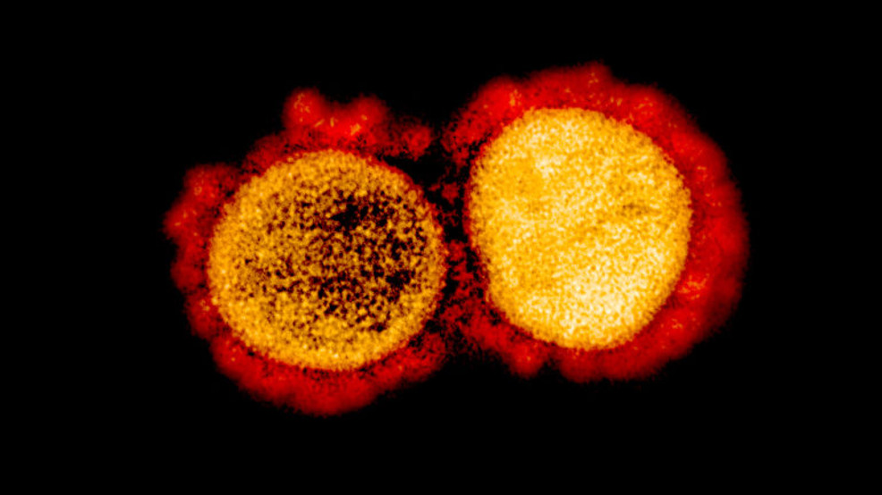 This transmission electron micrograph shows SARS-CoV-2 virus particles isolated from a patient suffering from COVID-19. The image was captured and color-enhanced at the NIAID Integrated Research Facility in Fort Detrick, Maryland.