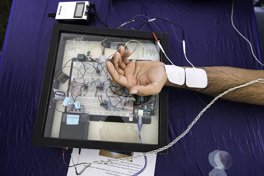 A person's wrist attached to a monitoring device.