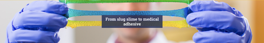 This tough gel can stretch 20 times its length without breaking, which is more than what the most resilient rubber band can do.