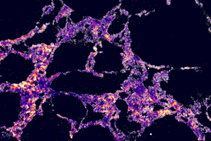 biomedical optics