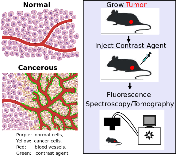 contrast agent accumulation