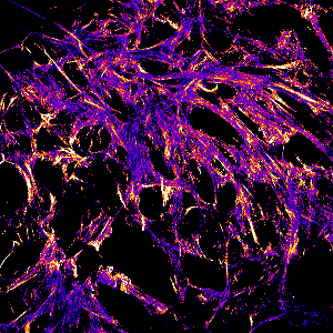 forward/backward scattering