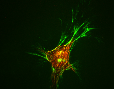 matrix adhesions