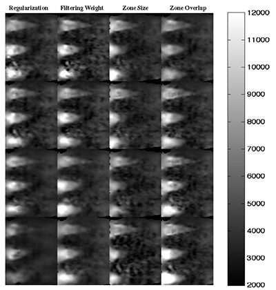 Elastographic imaging example.