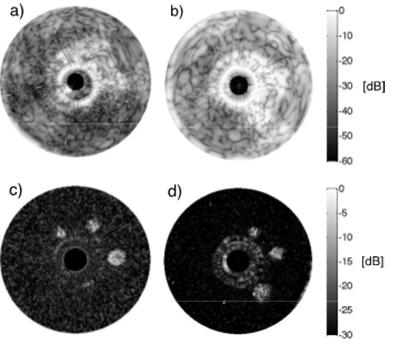 Harmonic imaging example.