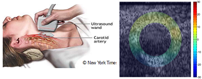 Vascular imaging example.