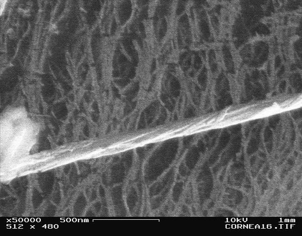 SEM1