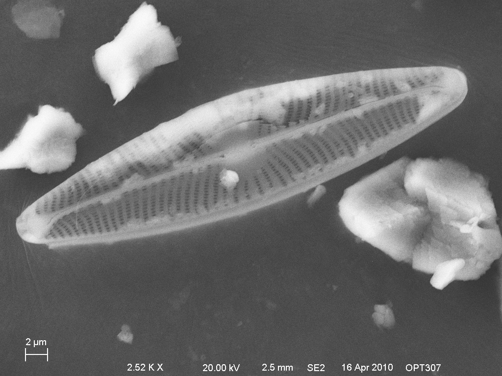 diatom