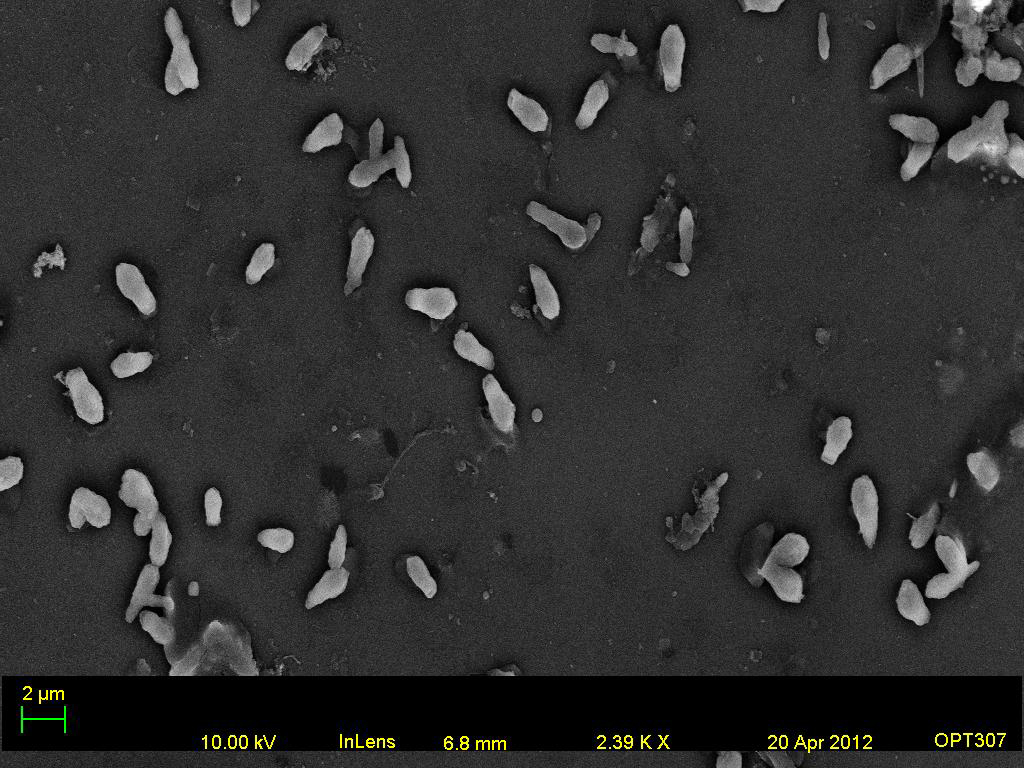 Genesee River Water Calcium Drops Low Accelerating Voltage