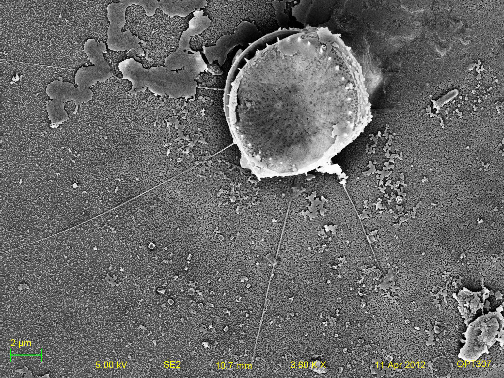 Genesee River Water Circle Diatom