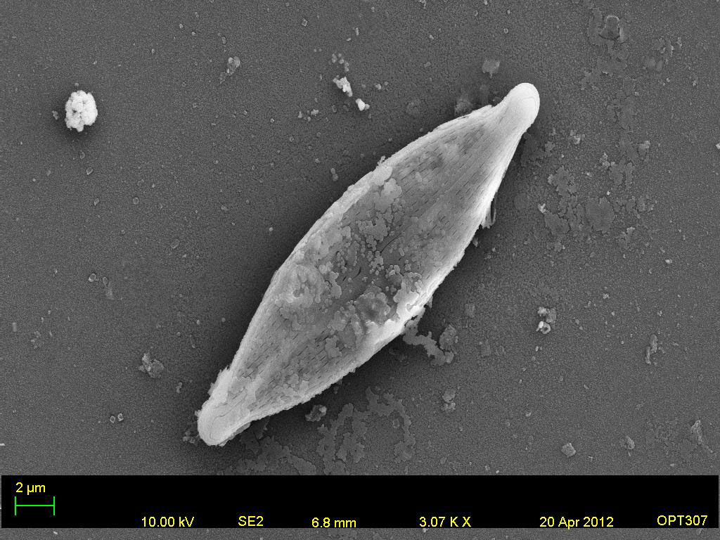Genesee River Water Diatom 2
