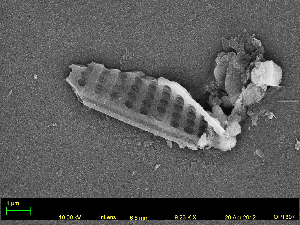 Genesee River Water Diatom 3