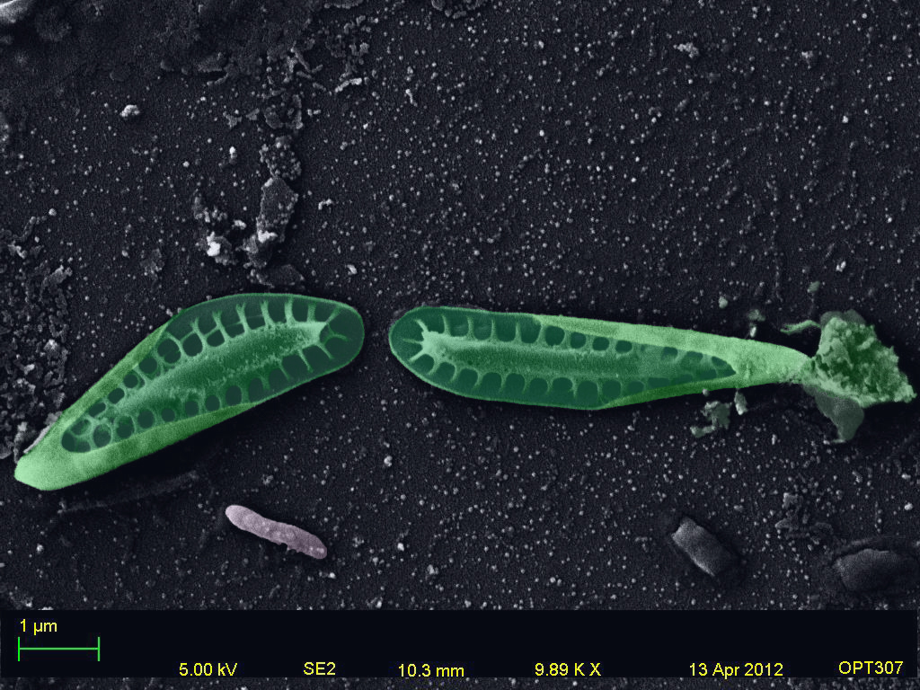 Genesee River Water Diatom 1 Colorized