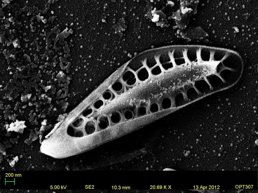 Genesee River Water Diatom 1 Zoom