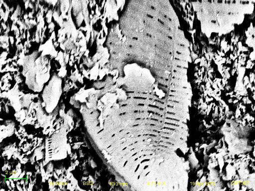 Diatom Type 1 X-Ray