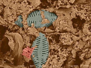 diatom type 1