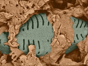 diatom type 1 close up