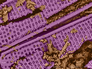 Diatom Type 3 close up