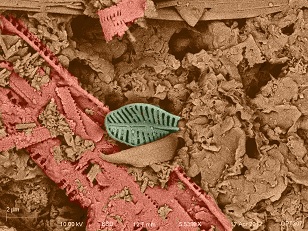 diatom type 1