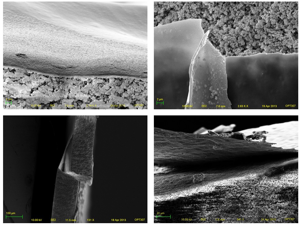 skin layer