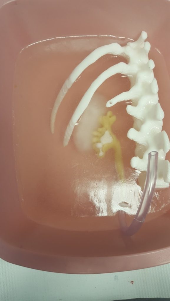 Current abdomen model used in the Simulation Innovation Lab.