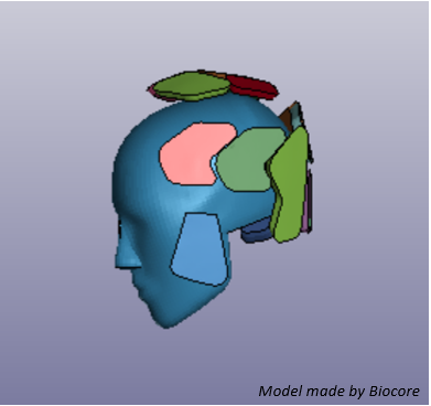 Figure 2: The soft foam components of the helmet, shown on the model head.