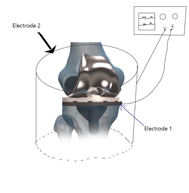 Design of the medical device to be wrapped around the knee.