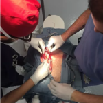 surgeons operating on artificial organ