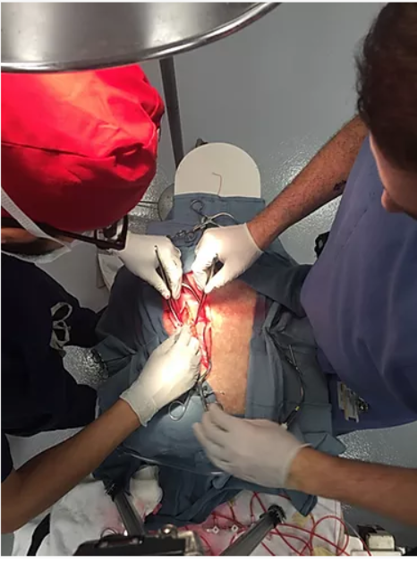 surgeons operating on artificial organ