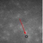 Figure 1. Kidney model polymer (40% DMSO + 5% PVA) under IR light, with visible