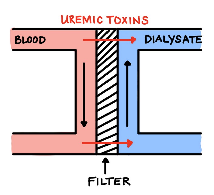 Hemodialysis Inline Analysis University of Rochester, Senior Design Day