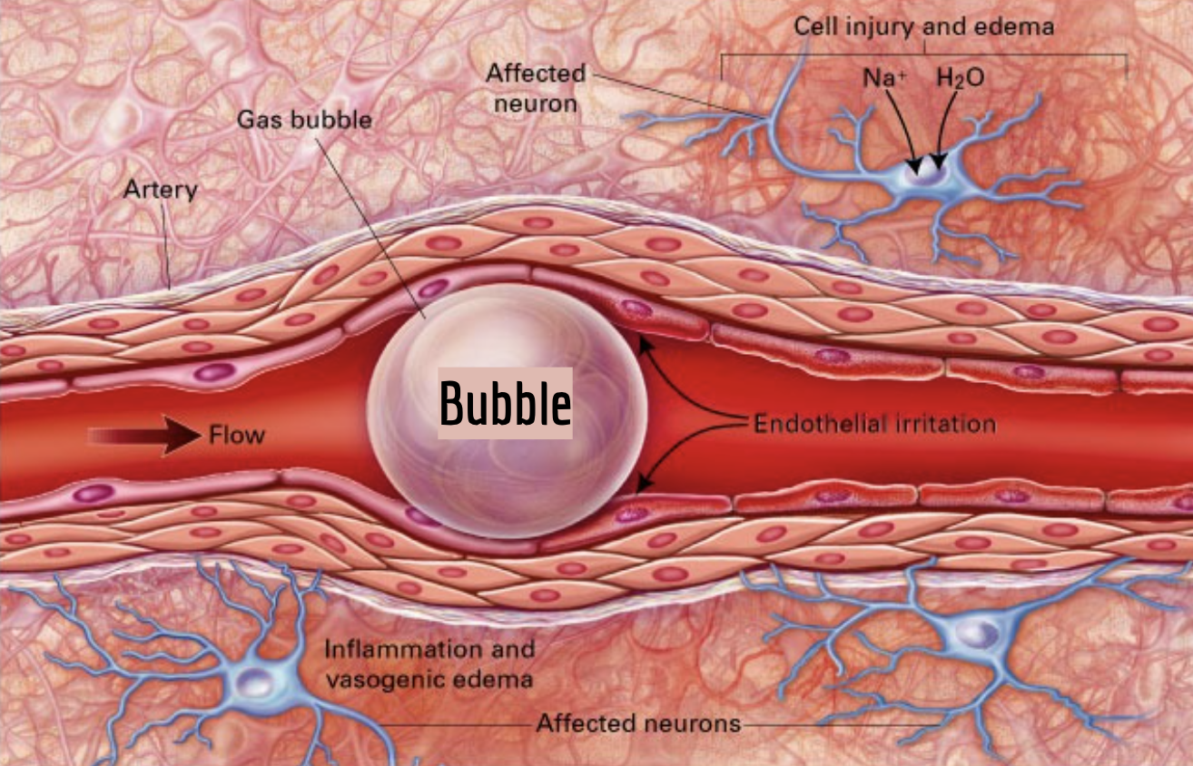 Bubble Trouble Senior Design Day